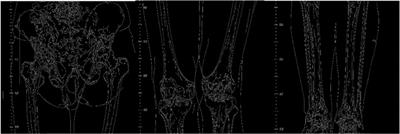 A new automatic stitching method for full-length lower limb radiography